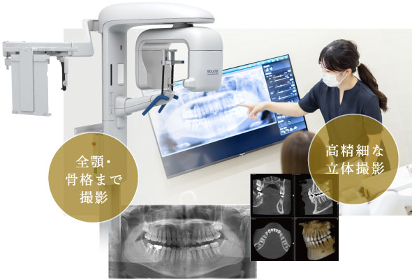 全顎・骨格まで撮影、高精細な立体撮影