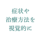 症状や治療方法を視覚的に