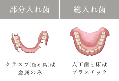 部分入れ歯：クラスプ（留め具）は金属のみ　総入れ歯：人工歯と床はプラスチック