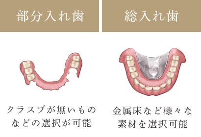 部分入れ歯：クラスプが無いものなどの選択が可能　総入れ歯：金属床など様々な素材を選択可能